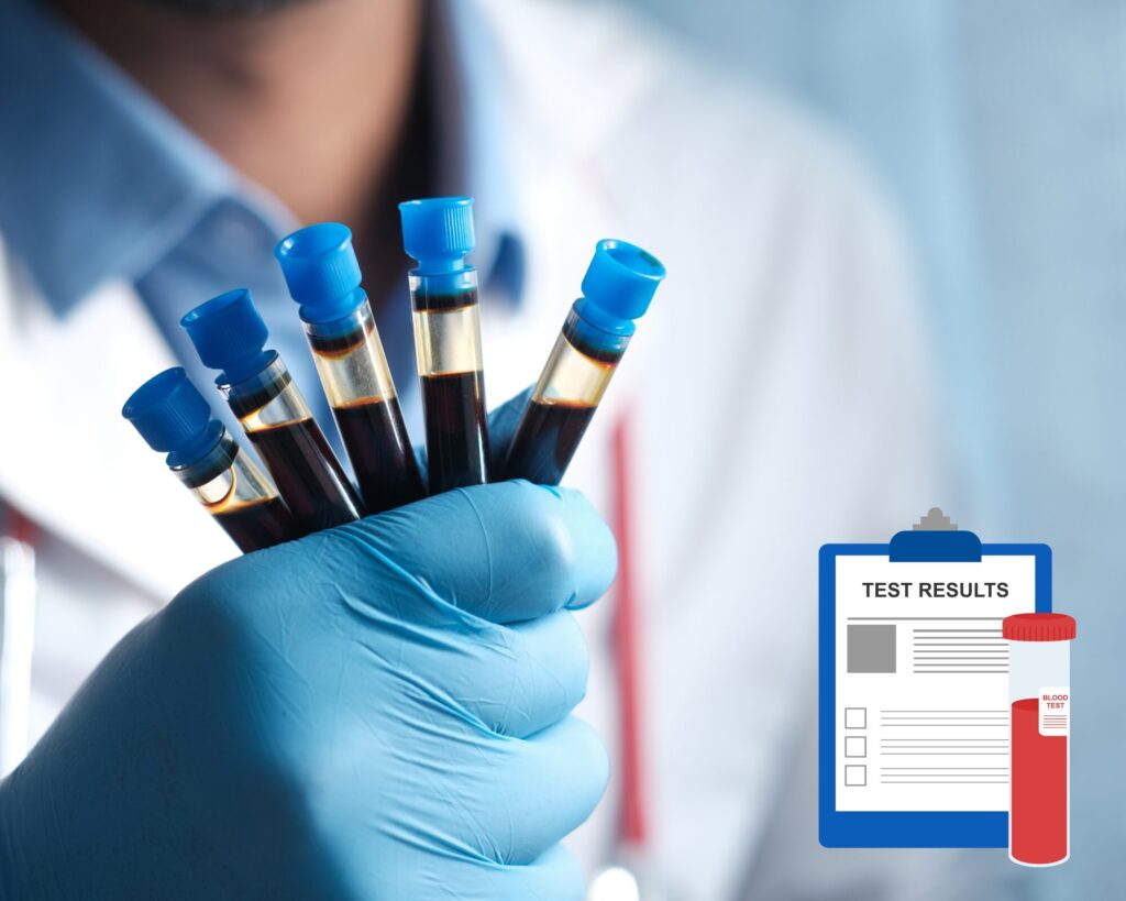 Optimalios kraujo tyrimų normos, kai žemas feritinas susijęs su uždegimu