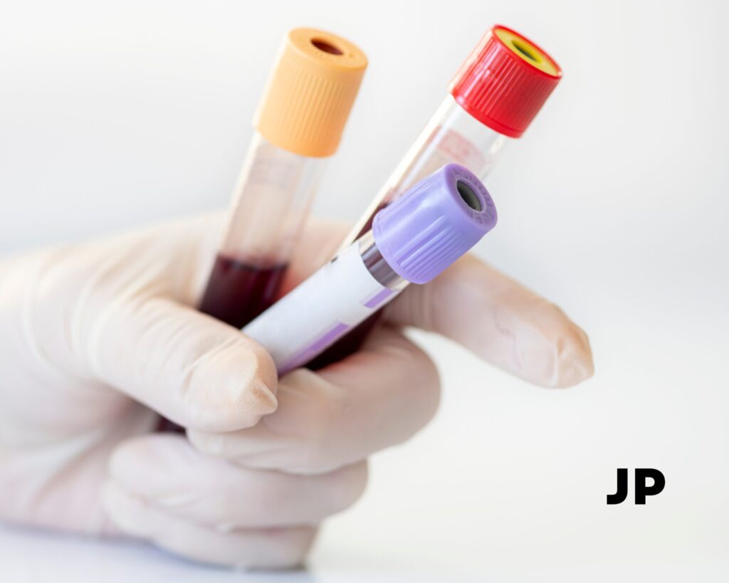 Kokius tyrimus verta atlikti kartu su feritinu