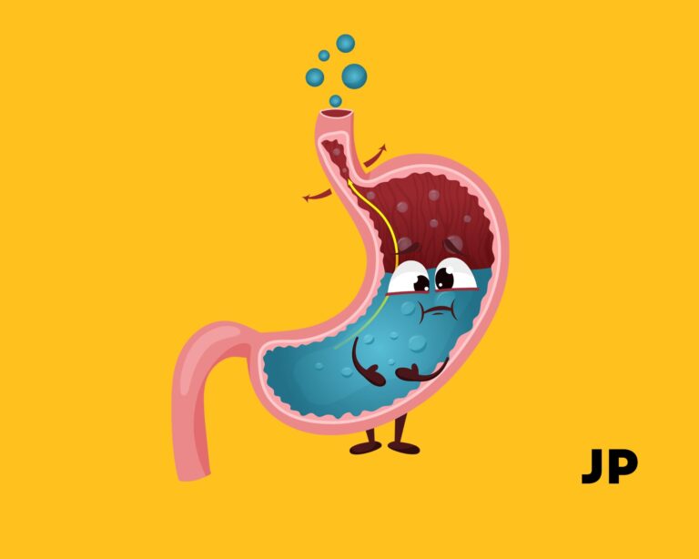 Sumažėjusio skrandžio rūgštingumo požymiai: kaip juos atpažinti?